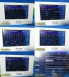 SPACELABS 2010  Ultraview DM3 Masimo Set SpO2 Spot Monitor
