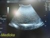GE HEALTHCARE GE Ultrasound 3.5C Ref 2050357 Convex Array Ultrasound Transducer