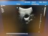PHILIPS C9-4 Ultrasound Transducer
