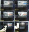 GE HEALTHCARE 2007 GE M12L Matrix Array Linear Array Ultrasound Transducer