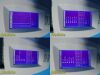 VITAL DIAGNOSTICS Excyte 20 Vital Diagnostic Excyte 20 Automated ESR Analyzer