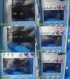 IMPACT Instrum Eagle Uni-Vent Series  Portable Device 754 W/ NEW BATTERY