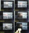 GE 7L Ref 2302648 Linear Array Ultrasound Transducer Probe Ref 2302648 Ultrasound Transducer