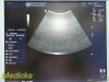 GE M7C Matrix Convex Array Ultrasound Transducer Probe Ref 2283695 Ultrasound Transducer