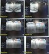 GE M7C Matrix Convex Array Ultrasound Transducer Probe Ref 2283695 Ultrasound Transducer