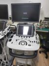 SAMSUNG H60 Ultrasound - OB / GYN
