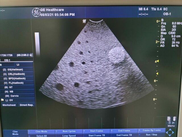 GE E8CS Ultrasound Transducer