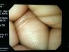 OLYMPUS GIF-H260 Endoscope