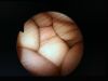 OLYMPUS BF- 40 Endoscope