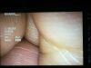 OLYMPUS WA50021B Endoscope