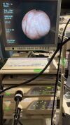 OLYMPUS GIF-PQ260 Gastroscope