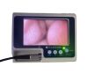 VERATHON Glidescope Portable GVL Video Laryngoscope Monitor W 1/2 Camera button Laryngoscope