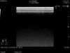 HITACHI L441 Ultrasound Transducer
