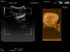 HITACHI CV524 Ultrasound Transducer
