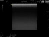 HITACHI L53 Ultrasound Transducer