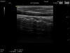 HITACHI L53 Ultrasound Transducer