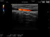 HITACHI L53 Ultrasound Transducer