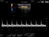HITACHI L53 Ultrasound Transducer