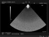 HITACHI S50 Ultrasound Transducer