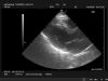 HITACHI S50 Ultrasound Transducer