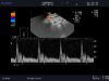 ALOKA UST-9118 Ultrasound Transducer