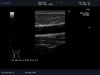 ALOKA UST-547 Ultrasound Transducer