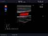 ALOKA UST-547 Ultrasound Transducer