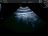 GE RIC5-9-D Ultrasound Transducer