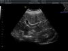 GE C4-8-D Ultrasound Transducer
