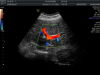 GE C4-8-D Ultrasound Transducer