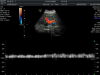 GE C4-8-D Ultrasound Transducer