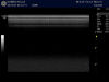GE ML6-15-D Ultrasound Transducer