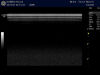 GE ML6-15-D Ultrasound Transducer