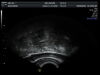 GE E8C-RS Ultrasound Transducer