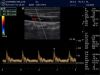GE 9L Ultrasound Transducer