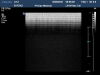 PHILIPS L9-3 Ultrasound Transducer