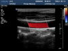 PHILIPS L9-3 Ultrasound Transducer