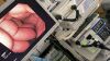 OLYMPUS GIF-H290 Gastroscope