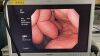 OLYMPUS GIF-H290 Gastroscope