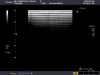 TOSHIBA PLT-604AT Ultrasound Transducer