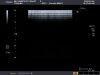 TOSHIBA PLT-604AT Ultrasound Transducer
