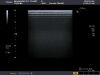 TOSHIBA PLT-704SBT Ultrasound Transducer