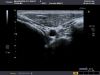 TOSHIBA PLT-805AT Ultrasound Transducer