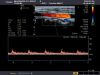 TOSHIBA PLT-805AT Ultrasound Transducer