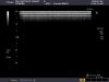 TOSHIBA PLT-805AT Ultrasound Transducer