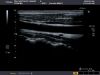 TOSHIBA PLT-805AT Ultrasound Transducer