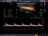 TOSHIBA PLT-805AT Ultrasound Transducer