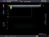 TOSHIBA PLT-805AT Ultrasound Transducer