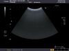 TOSHIBA PVT-674BT Ultrasound Transducer