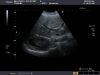 TOSHIBA PVT-674BT Ultrasound Transducer